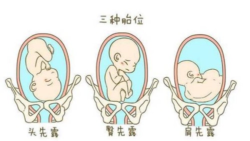取卵后腹水一般发生在第几天？发生腹水之后这样方法治疗可以有效帮忙